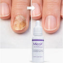 MicoX® Gel Antifúngico Combate os fungos e protege suas unhas