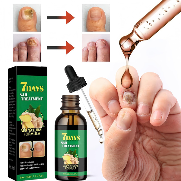 Óleo Antifúngico HerbalCare